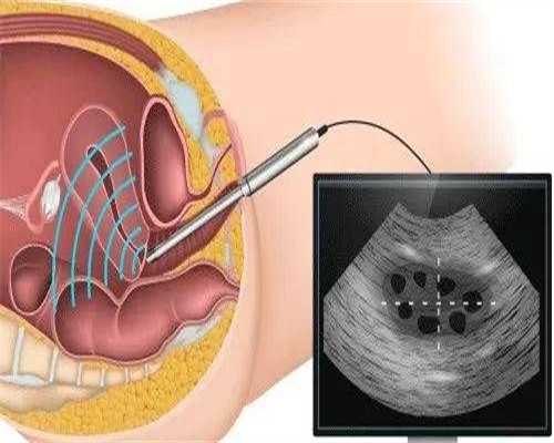 十堰市人民医院做试管婴儿费用大约多少钱？附试管价格表？