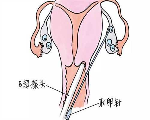 湖北做试管婴儿比较好的医院排名！TOP10试管婴儿机构