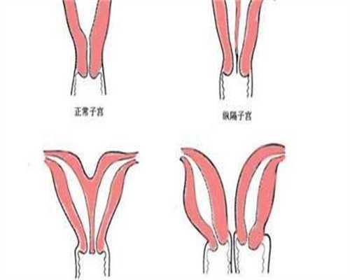 代孕公司哪家成功率高_试管包儿子吗,先天性始基子宫可以做试管婴儿胚胎移植