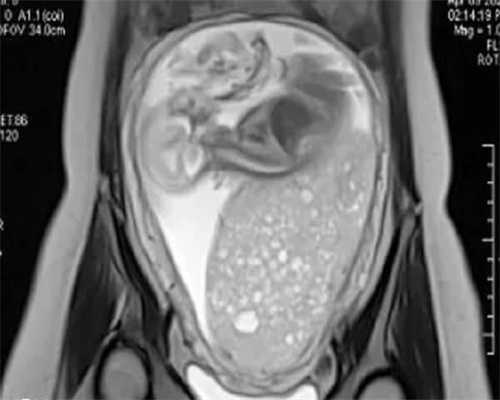 国内助孕一般多少钱_正规的供卵代孕哪里好,2026年西宁能通过试管技术包怀孕的
