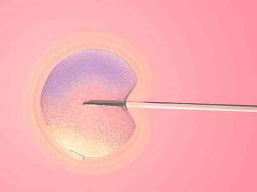 代孕公司哪家专业,子宫憩室做宫腹腔镜手术多少钱
						