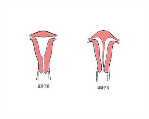 湖北助孕贵吗，湖北代生助孕