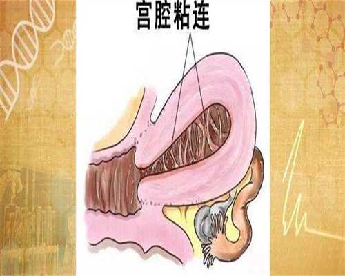 借卵自怀条件：男性如何预防畸形精子症？