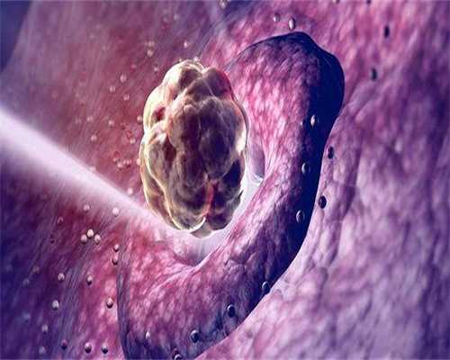 代怀助孕机构:生殖器不卫生严重影响不育