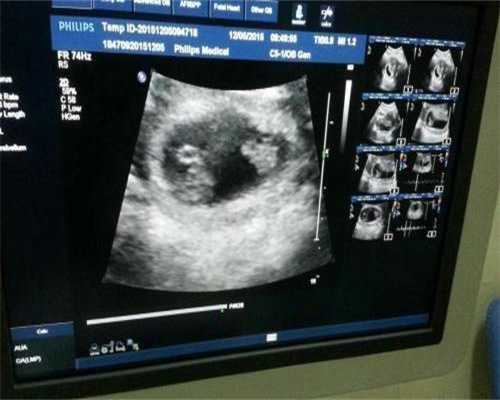 孝感有做试管的医院吗孝感可以做三代试管婴儿吗