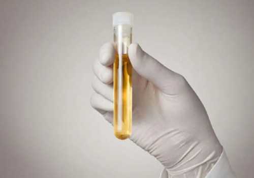 第三代代孕花费,卵巢多囊样改变严重吗卵巢多囊样改变是什么