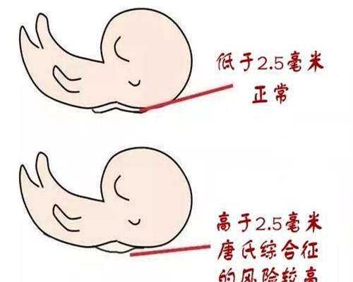 武汉供精试管医院哪家好_最好泰国供卵机构,湖北武汉哪家供卵试管婴儿好？